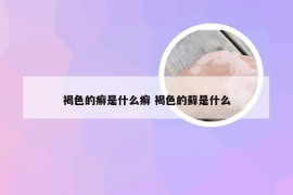 褐色的癣是什么癣 褐色的藓是什么