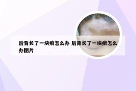 后背长了一块癣怎么办 后背长了一块癣怎么办图片