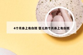 4个月身上有白斑 婴儿四个月身上有白斑