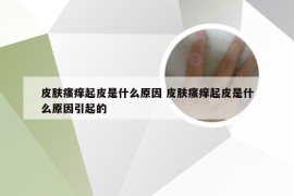 皮肤瘙痒起皮是什么原因 皮肤瘙痒起皮是什么原因引起的