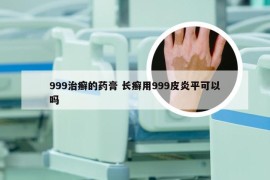 999治癣的药膏 长癣用999皮炎平可以吗