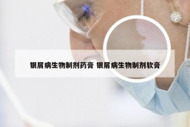 银屑病生物制剂药膏 银屑病生物制剂软膏