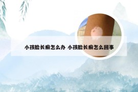 小孩脸长癣怎么办 小孩脸长癣怎么回事