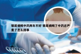 银屑病喝中药两年不好 银屑病喝了中药还严重了怎么回事