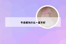 牛皮癣为什么一直不好