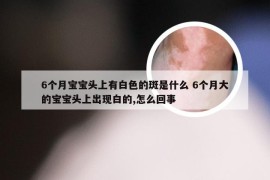 6个月宝宝头上有白色的斑是什么 6个月大的宝宝头上出现白的,怎么回事