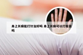 身上长癣能打针治好吗 身上长癣可以打疫苗吗