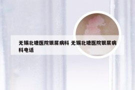 无锡北塘医院银屑病科 无锡北塘医院银屑病科电话