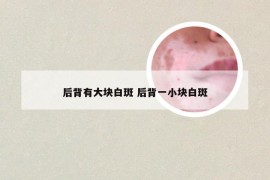 后背有大块白斑 后背一小块白斑