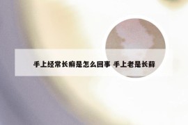 手上经常长癣是怎么回事 手上老是长藓