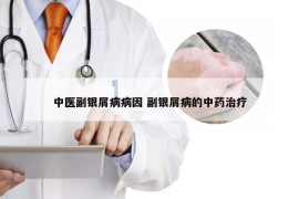 中医副银屑病病因 副银屑病的中药治疗