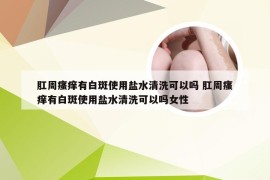 肛周瘙痒有白斑使用盐水清洗可以吗 肛周瘙痒有白斑使用盐水清洗可以吗女性