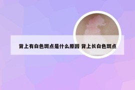 背上有白色斑点是什么原因 背上长白色斑点