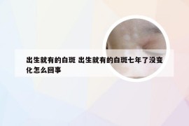 出生就有的白斑 出生就有的白斑七年了没变化怎么回事