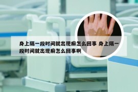 身上隔一段时间就出现癣怎么回事 身上隔一段时间就出现癣怎么回事啊