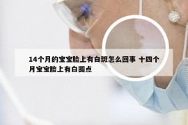 14个月的宝宝脸上有白斑怎么回事 十四个月宝宝脸上有白圆点