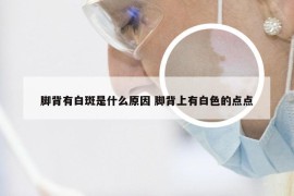 脚背有白斑是什么原因 脚背上有白色的点点