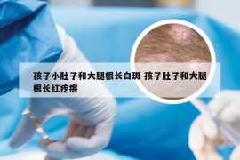 孩子小肚子和大腿根长白斑 孩子肚子和大腿根长红疙瘩