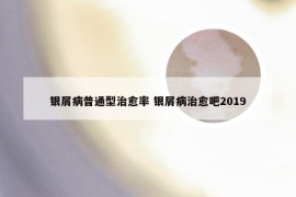 银屑病普通型治愈率 银屑病治愈吧2019