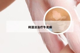 利湿法治疗牛皮癣