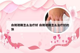 白斑初期怎么治疗好 白斑初期怎么治疗好的快