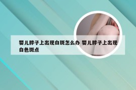 婴儿脖子上出现白斑怎么办 婴儿脖子上出现白色斑点