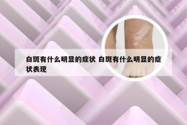 白斑有什么明显的症状 白斑有什么明显的症状表现