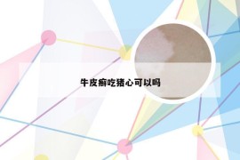 牛皮癣吃猪心可以吗