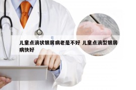 儿童点滴状银屑病老是不好 儿童点滴型银屑病快好