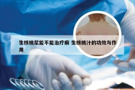 生核桃浆能不能治疗癣 生核桃汁的功效与作用