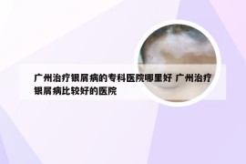 广州治疗银屑病的专科医院哪里好 广州治疗银屑病比较好的医院