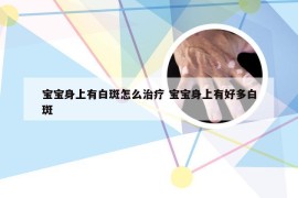 宝宝身上有白斑怎么治疗 宝宝身上有好多白斑