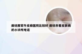 廊坊那家牛皮癣医院比较好 廊坊市看皮肤病的小诊所电话