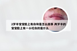 2岁半宝宝脸上有白块是怎么回事 两岁半的宝宝脸上有一小坨白的是什么