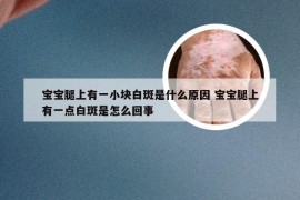 宝宝腿上有一小块白斑是什么原因 宝宝腿上有一点白斑是怎么回事