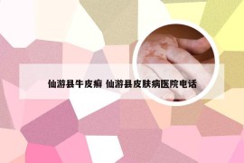 仙游县牛皮癣 仙游县皮肤病医院电话