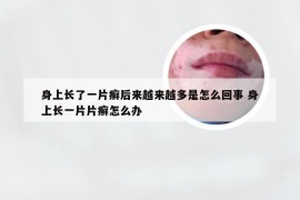 身上长了一片癣后来越来越多是怎么回事 身上长一片片癣怎么办