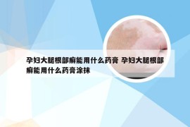 孕妇大腿根部癣能用什么药膏 孕妇大腿根部癣能用什么药膏涂抹