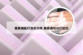 银屑病能打消炎针吗 银屑病可以打的针