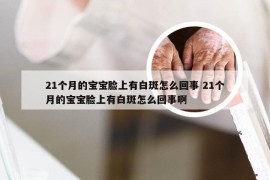 21个月的宝宝脸上有白斑怎么回事 21个月的宝宝脸上有白斑怎么回事啊