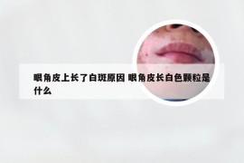 眼角皮上长了白斑原因 眼角皮长白色颗粒是什么