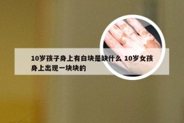 10岁孩子身上有白块是缺什么 10岁女孩身上出现一块块的