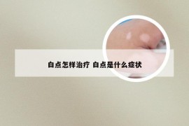 白点怎样治疗 白点是什么症状