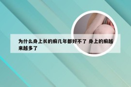 为什么身上长的癣几年都好不了 身上的癣越来越多了