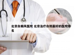 北京白癜风医院 北京治疗白斑最好的医院排名