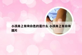 小孩身上有块白色的是什么 小孩身上有白块图片