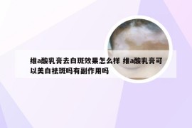 维a酸乳膏去白斑效果怎么样 维a酸乳膏可以美白祛斑吗有副作用吗