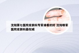 沈阳第七医院皮肤科专家谁看的好 沈阳哪家医院皮肤科最权威