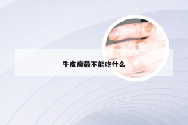 牛皮癣最不能吃什么