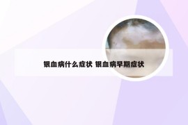 银血病什么症状 银血病早期症状